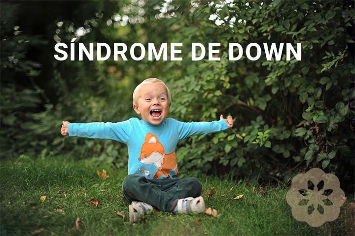 cuidados especiais com sindrome de down